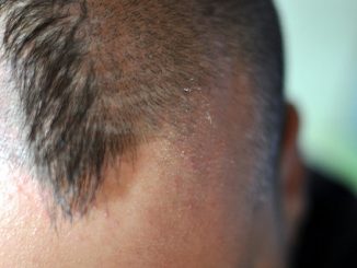 Coupe de cheveux, crête