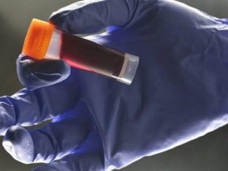 nuovo-ceppo-hiv-768x421