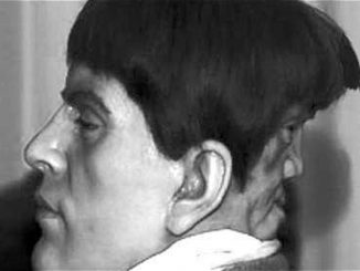 edward mordake