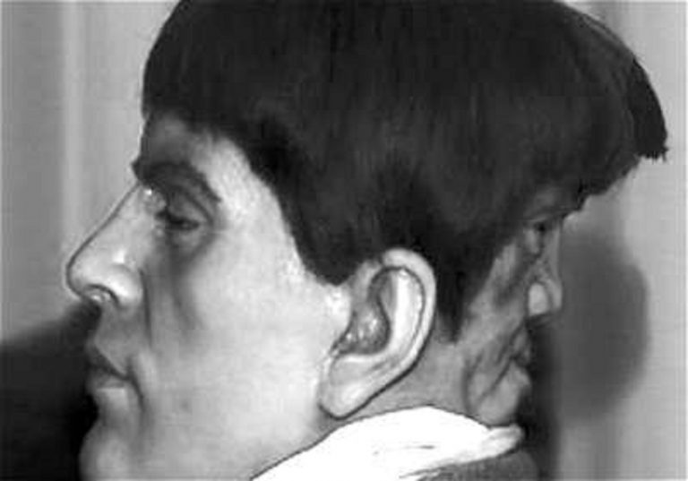 edward-mordake