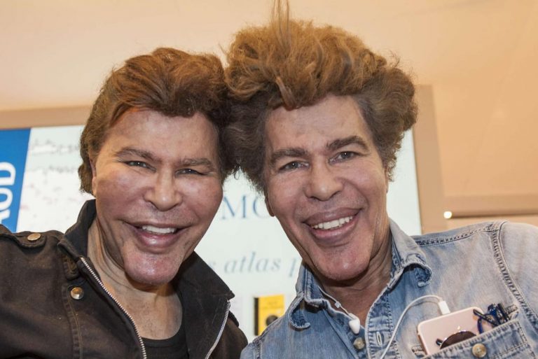 Deux frères jumeaux meurent du coronavirus